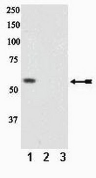 Anti-phospho-PTEN (Ser370) Antibody Upstate&#174;, from rabbit