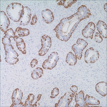 Cytokeratin (34betaE12) Mouse Monoclonal Antibody