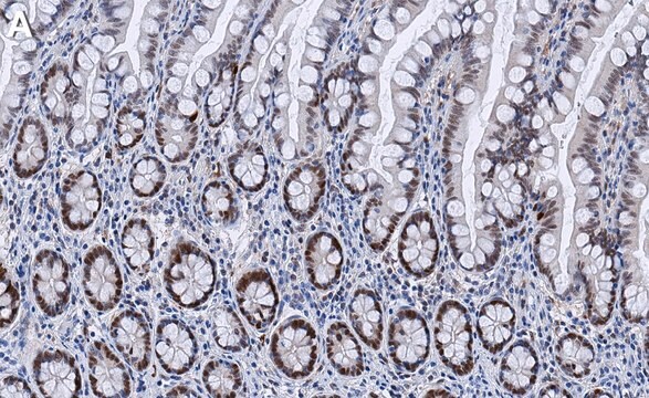 Anti-Vitamin D3 Receptor Antibody, clone 1M19 ZooMAb&#174; Rabbit Monoclonal recombinant, expressed in HEK 293 cells