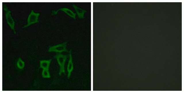 Anti-GRM5 antibody produced in rabbit affinity isolated antibody