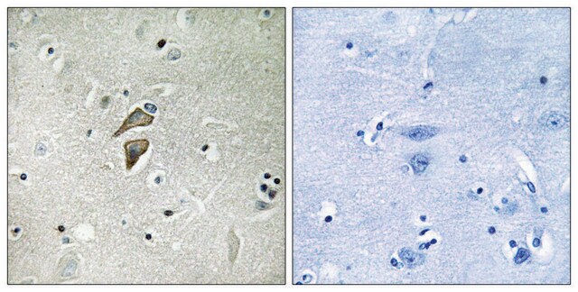 抗RNF149抗体 ウサギ宿主抗体 affinity isolated antibody