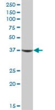 抗AKR1C1抗体 マウス宿主抗体 IgG fraction of antiserum, buffered aqueous solution