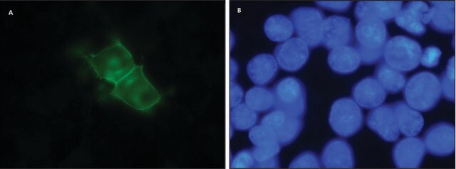 抗-D1 多巴胺受体抗体，大鼠单克隆抗体 大鼠抗 clone 1-1-F11 s.E6, purified from hybridoma cell culture