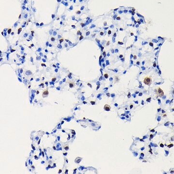 Anti- Cyclin D1 antibody produced in rabbit