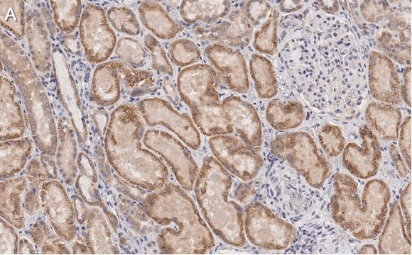 Anti-Claudin 6 Antibody, clone 1B22 ZooMAb&#174; Rabbit Monoclonal recombinant, expressed in HEK 293 cells