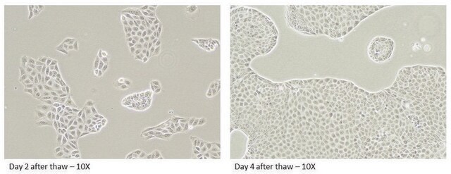 Canine MDR1 Knockout, Human BCRP/OATP2B1 double Knockin MDCKII Cells