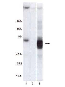 ZAP-70 Protein, active, 20 &#181;g Active, recombinant, human, full length ZAP-70 containing a C-terminal His6 tag, for use in Kinase Assays.