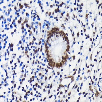 Anti-KAP1/TRIM28 antibody produced in rabbit