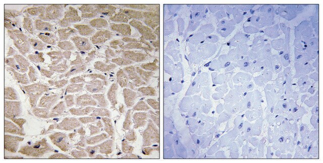 Anti-Collagen XVI &#945;1 antibody produced in rabbit affinity isolated antibody