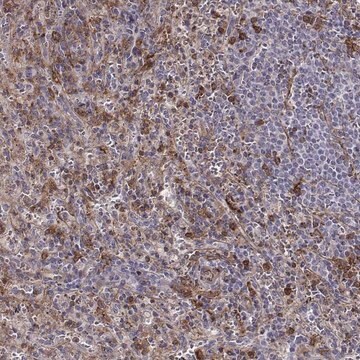 Anti-ZYX antibody produced in rabbit Prestige Antibodies&#174; Powered by Atlas Antibodies, affinity isolated antibody, buffered aqueous glycerol solution