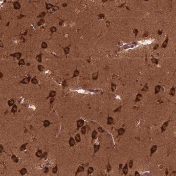 Anti-CYFIP1 antibody produced in rabbit Prestige Antibodies&#174; Powered by Atlas Antibodies, affinity isolated antibody, buffered aqueous glycerol solution