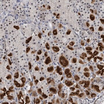 Anti-TRDMT1 antibody produced in rabbit Prestige Antibodies&#174; Powered by Atlas Antibodies, affinity isolated antibody, buffered aqueous glycerol solution