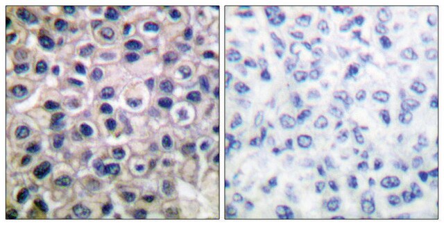 抗MMP-14 ウサギ宿主抗体 affinity isolated antibody