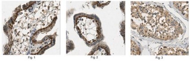 Anti-Cullin-5 (CUL5) Antibody from rabbit, purified by affinity chromatography