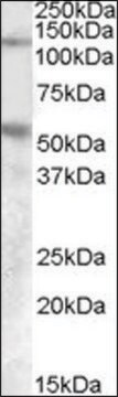 Anti-PALLD antibody produced in goat affinity isolated antibody, buffered aqueous solution