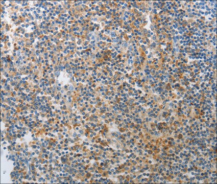 Anty-AD7C-NTP affinity isolated antibody