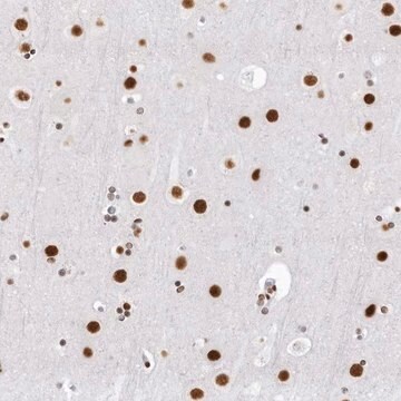 Anti-DHX9 antibody produced in rabbit Prestige Antibodies&#174; Powered by Atlas Antibodies, affinity isolated antibody, buffered aqueous glycerol solution