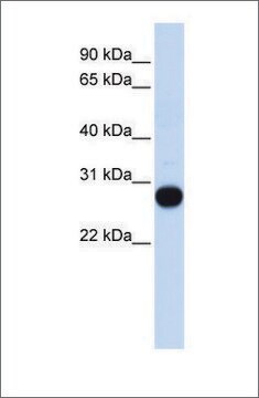 抗TCEAL4抗体 ウサギ宿主抗体 affinity isolated antibody