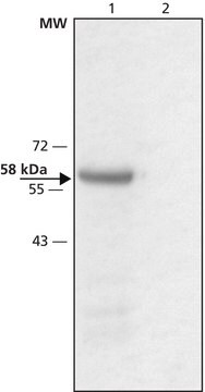 Anti-monoamine oxydase&nbsp;B antibody produced in rabbit ~1.5&#160;mg/mL, affinity isolated antibody, buffered aqueous solution