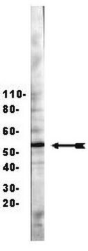 Anticuerpo anti-HNF3&#946;/FOXA2 Upstate&#174;, from rabbit