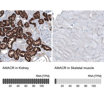 Monoclonal Anti-AMACR antibody produced in mouse Prestige Antibodies&#174; Powered by Atlas Antibodies, clone CL9362, purified immunoglobulin, buffered aqueous glycerol solution