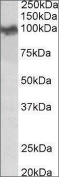 Anti-App (N-terminal) antibody produced in goat affinity isolated antibody, buffered aqueous solution