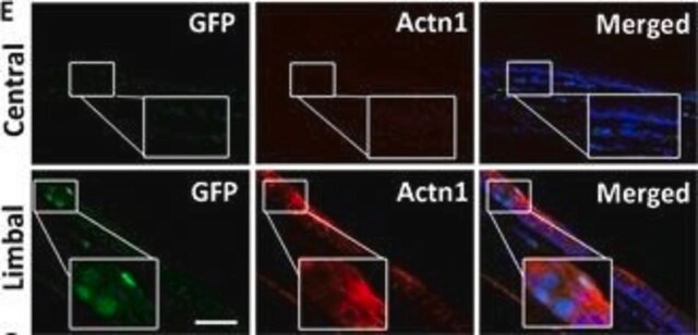 抗ACTN1 ウサギ宿主抗体 Prestige Antibodies&#174; Powered by Atlas Antibodies, affinity isolated antibody, buffered aqueous glycerol solution