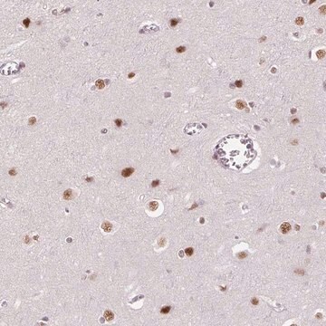 Anti-HNRNPDL antibody produced in rabbit Prestige Antibodies&#174; Powered by Atlas Antibodies, affinity isolated antibody, buffered aqueous glycerol solution