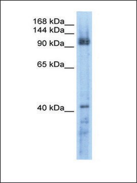 Anti-RECQL5 antibody produced in rabbit affinity isolated antibody