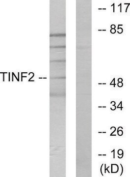 Anti-TINF2 antibody produced in rabbit affinity isolated antibody