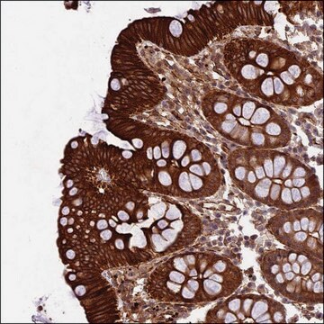 Anti-CFAP53 antibody produced in rabbit Prestige Antibodies&#174; Powered by Atlas Antibodies, affinity isolated antibody, buffered aqueous glycerol solution