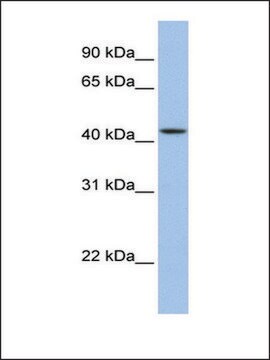 Anti-ZNF202 (AB2) antibody produced in rabbit affinity isolated antibody