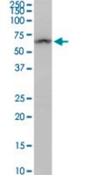 Anti-ALDH4A1 antibody produced in rabbit purified immunoglobulin, buffered aqueous solution