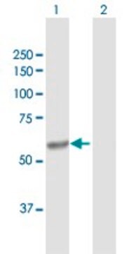 抗CYP4V2抗体 ウサギ宿主抗体 purified immunoglobulin, buffered aqueous solution