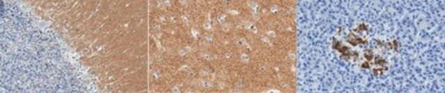 Anti-Synaptophysin Antibody, clone 10F6.1 clone 10F6.1, from mouse