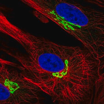 Anty-ARL1 Prestige Antibodies&#174; Powered by Atlas Antibodies, affinity isolated antibody