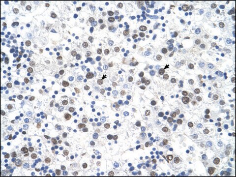 Anti-FECH (AB1) antibody produced in rabbit affinity isolated antibody