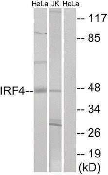 抗IRF4抗体 ウサギ宿主抗体 affinity isolated antibody