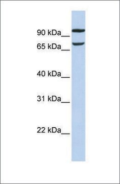 抗FAM38B抗体 ウサギ宿主抗体 affinity isolated antibody