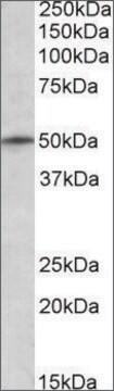 Anti-TRIM35 (N-terminal) antibody produced in goat affinity isolated antibody, buffered aqueous solution