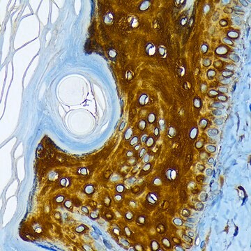 Anti-Cytokeratin 1 (KRT1) Antibody, clone 10W8J6, Rabbit Monoclonal