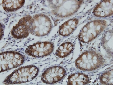 Monoclonal Anti-RTKN antibody produced in mouse clone 2E5, purified immunoglobulin, buffered aqueous solution