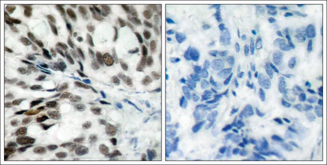 Anti-RB1 (Ab-780) antibody produced in rabbit affinity isolated antibody