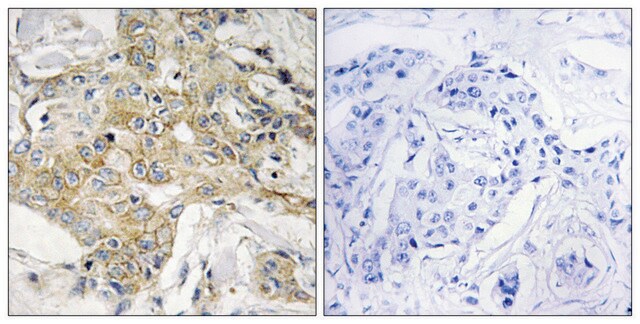 Anti-T4S1 antibody produced in rabbit affinity isolated antibody