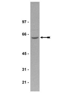 Anti-PP2A Antibody, A subunit Upstate&#174;, from rabbit