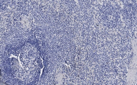 Anti-ATG9A Antibody, clone 5B11, ZooMAb&#174; Rabbit Monoclonal recombinant, expressed in HEK 293 cells