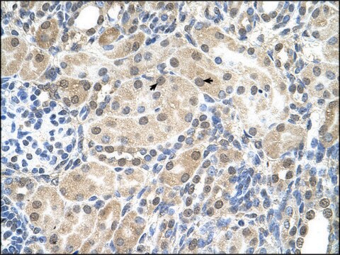 Anti-SLC9A9 antibody produced in rabbit affinity isolated antibody