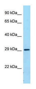 Anti-FCGR2B (C-terminal) antibody produced in rabbit affinity isolated antibody