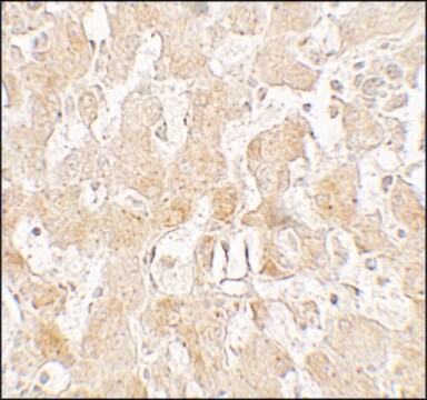 抗UCP1抗体 ウサギ宿主抗体 affinity isolated antibody