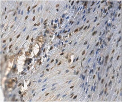 Anti-Lysine-specific demethylase 5C Antibody from rabbit, purified by affinity chromatography